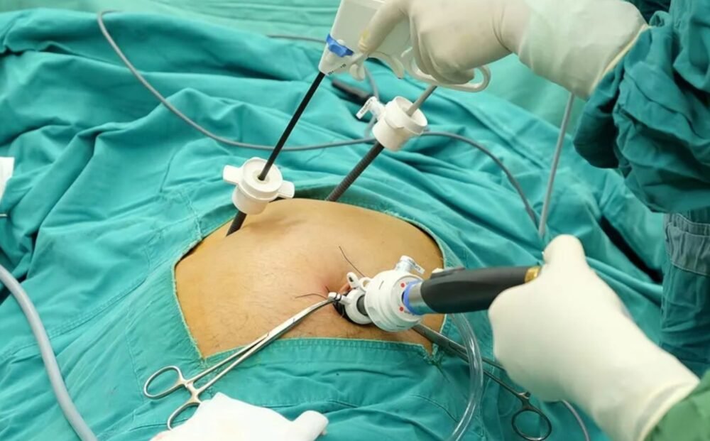 minimal access surgeries