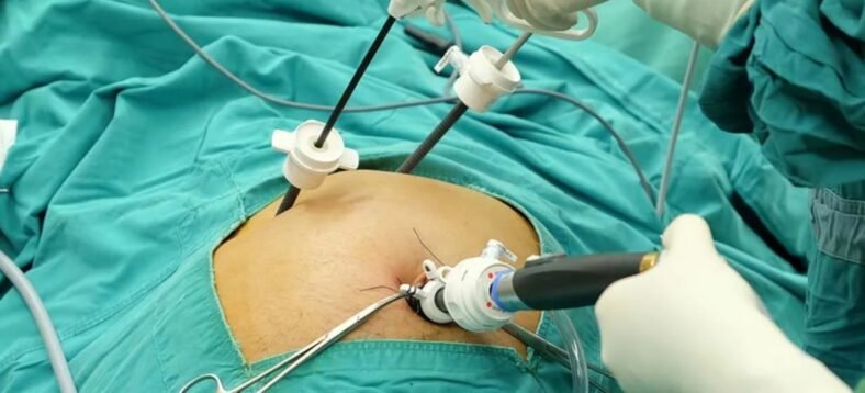 minimal access surgeries