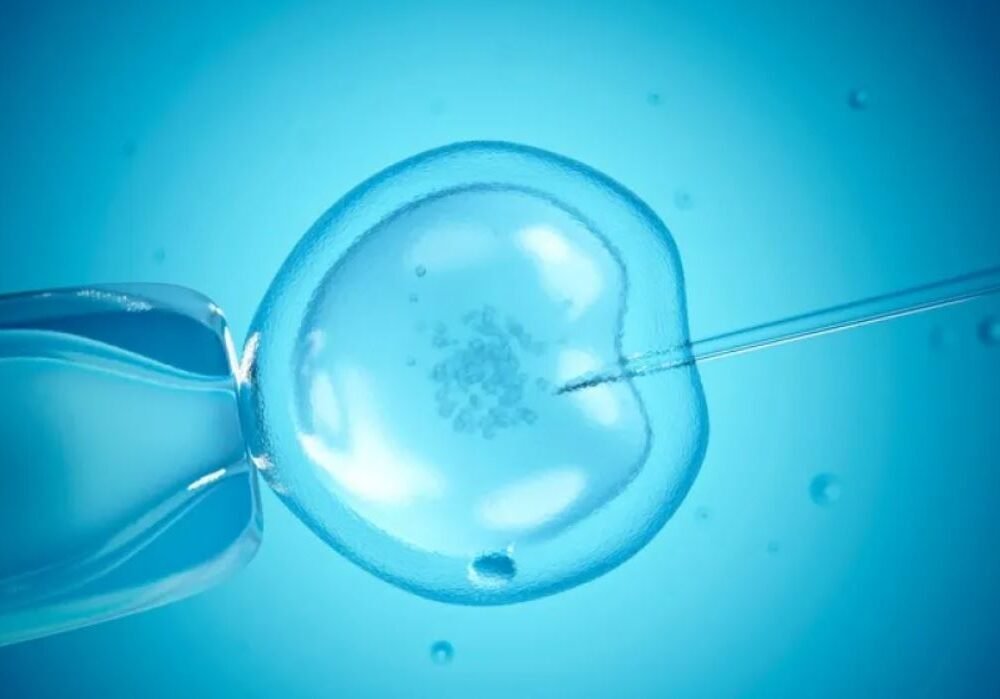 IVF2