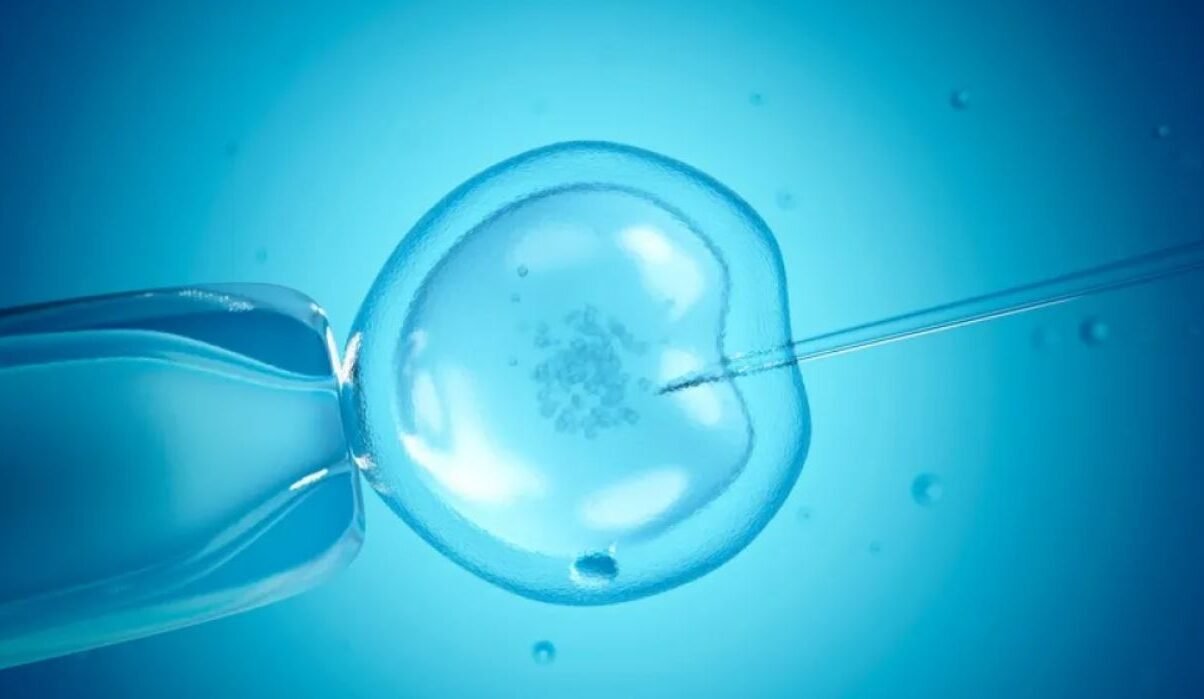IVF2